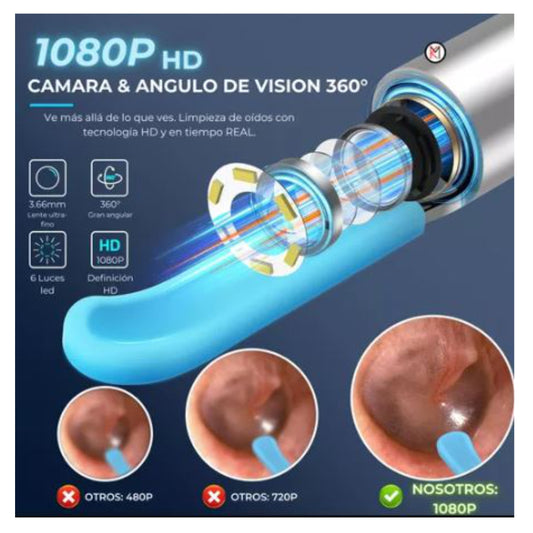 Otoclean Limpiador de Oídos con Cámara